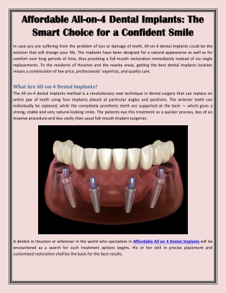 Affordable All-on-4 Dental Implants: The Smart Choice for a Confident Smile