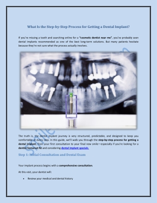 What Is the Step-by-Step Process for Getting a Dental Implant