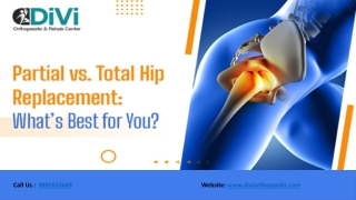 Partial vs. Total Hip Replacement | Best Hip Surgery Option