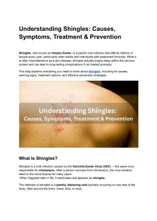 Understanding Shingles_ Causes, Symptoms, Treatment & Prevention
