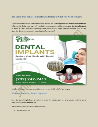 Are Same-Day Dental Implants Good Here’s What You Need to Know