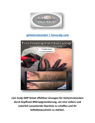 geheimratsecken | lionscalp.com