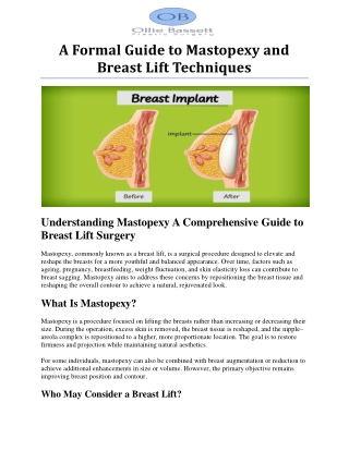 a formal guide to mastopexy and breast lift techniques