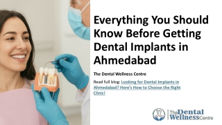 Everything You Should Know Before Getting Dental Implants in Ahmedabad