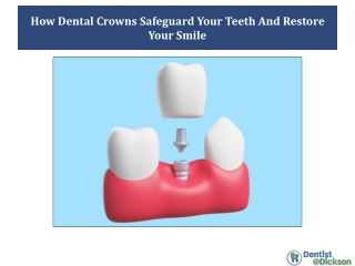 How Dental Crowns Safeguard Your Teeth And Restore Your Smile