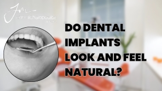 Do Dental Implants Look and Feel Natural