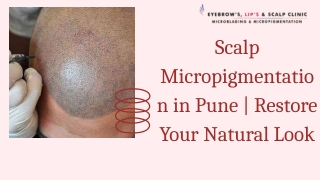 Scalp Micropigmentation in Pune  Restore Your Natural Look