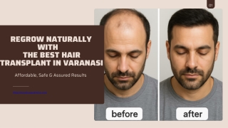 Regrow Naturally with the Best Hair Transplant in Varanasi – Affordable, Safe & Assured Results