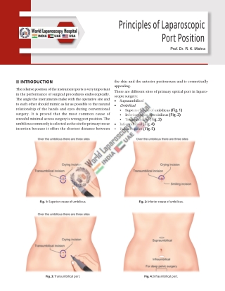 Principles of Laparoscopic Port Position