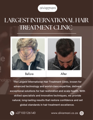 Largest International Hair Treatment Clinic