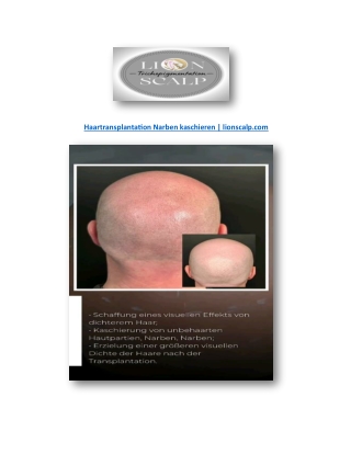 Haartransplantation Narben kaschieren | lionscalp.com