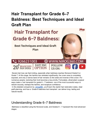 Hair Transplant for Grade 6–7 Baldness_ Best Techniques and Ideal Graft Plan