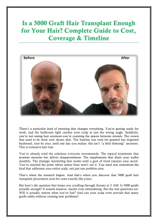 Is a 5000 Graft Hair Transplant Enough for Your Hair Complete Guide to Cost, Coverage & Timeline