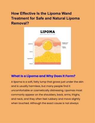 How Effective Is the Lipoma Wand Treatment for Safe and Natural Lipoma Removal?