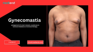 Gynecomastia