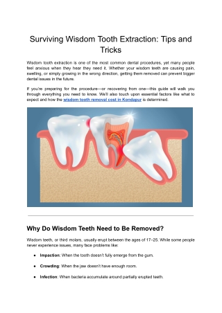 Surviving Wisdom Tooth Extraction_ Tips and Tricks (1)