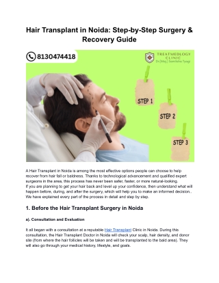 Hair Transplant in Noida: Step-by-Step Surgery & Recovery Guide