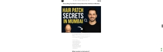 Everything You Need to Know About Hair Patches in Mumbai