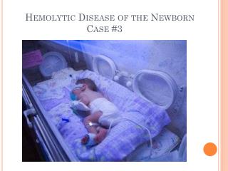 Hemolytic Disease of the Newborn Case #3