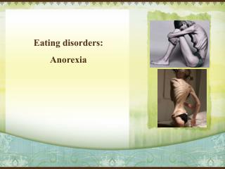 Eating disorders: Anorexia