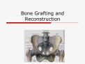Bone Grafting and Reconstruction