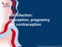 HIV infection: conception, pregnancy and contraception